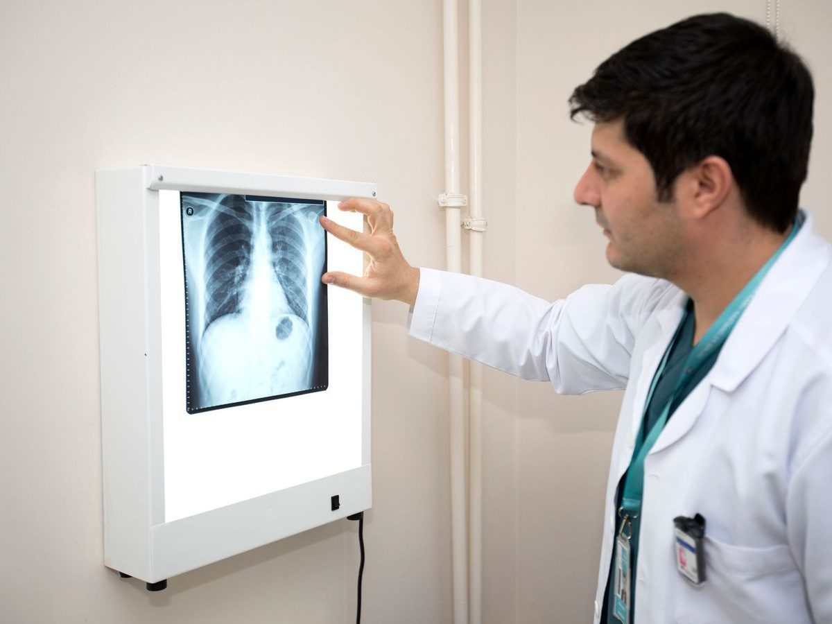 Comment devenir médecin pneumologue dans un cabinet médical ?